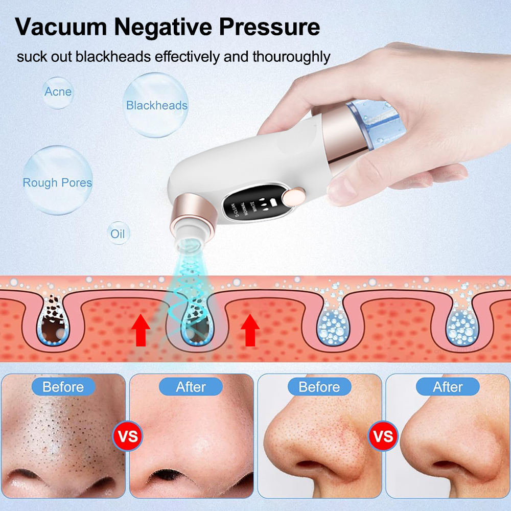Blackhead Remover Electric Bla - Air Bubble Remover recension och pris